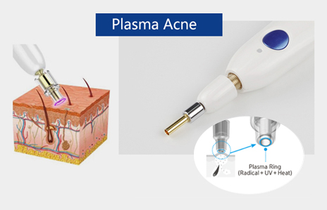 plasma-pen-3-1